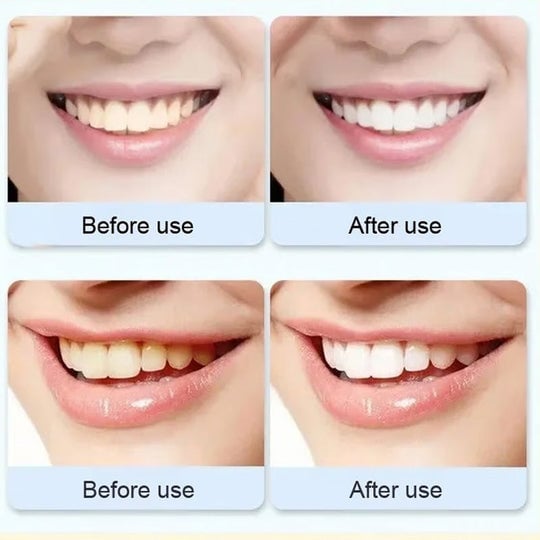 Tongue Scraper for Adults & Kids